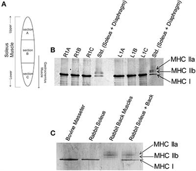 Hypertrophic Cardiomyopathy Cardiac Troponin C Mutations Differentially Affect Slow Skeletal and Cardiac Muscle Regulation